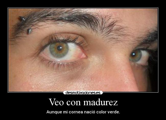 Veo con madurez - Aunque mi cornea nació color verde.