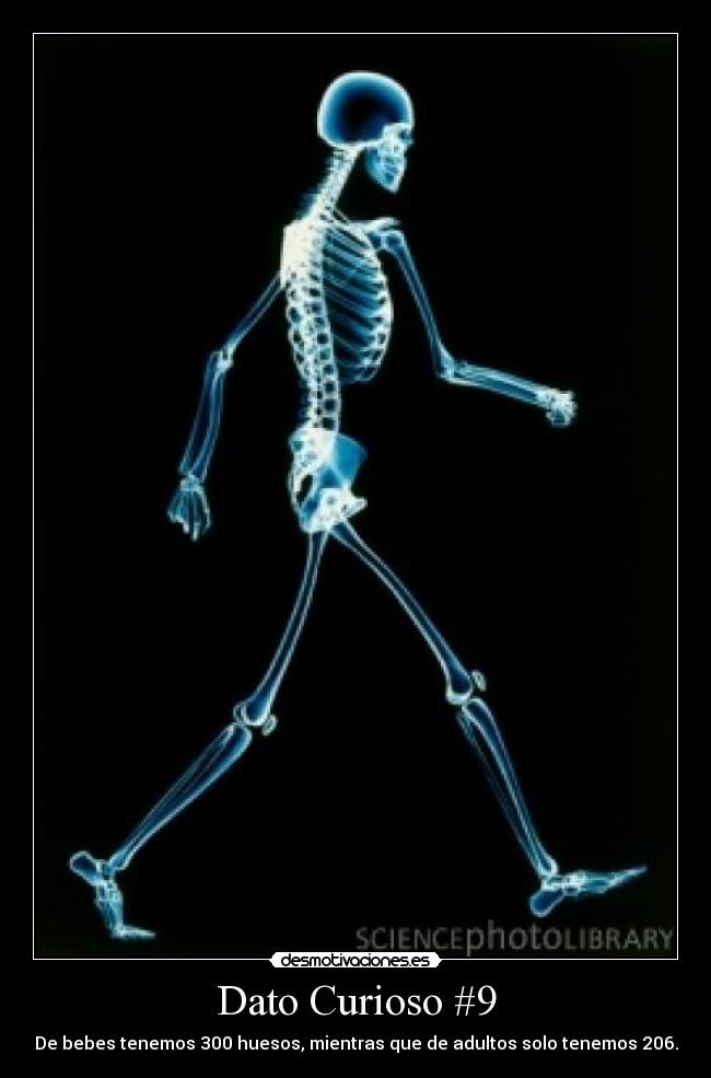 Dato Curioso #9 - De bebes tenemos 300 huesos, mientras que de adultos solo tenemos 206.