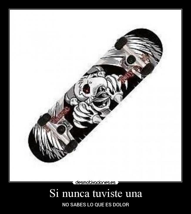 Si nunca tuviste una - NO SABES LO QUE ES DOLOR