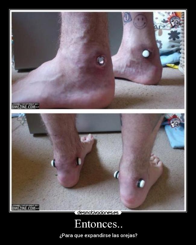 Entonces.. - ¿Para que expandirse las orejas?