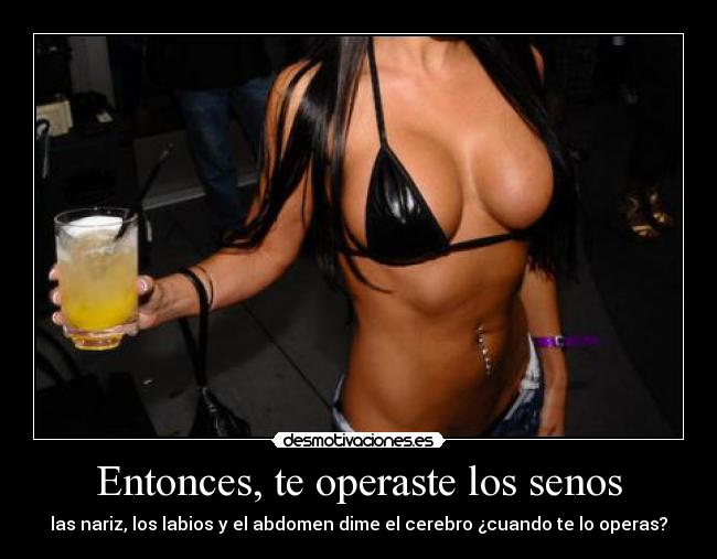 Entonces, te operaste los senos - las nariz, los labios y el abdomen dime el cerebro ¿cuando te lo operas?