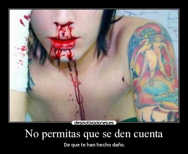 No permitas que se den cuenta - De que te han hecho daño.