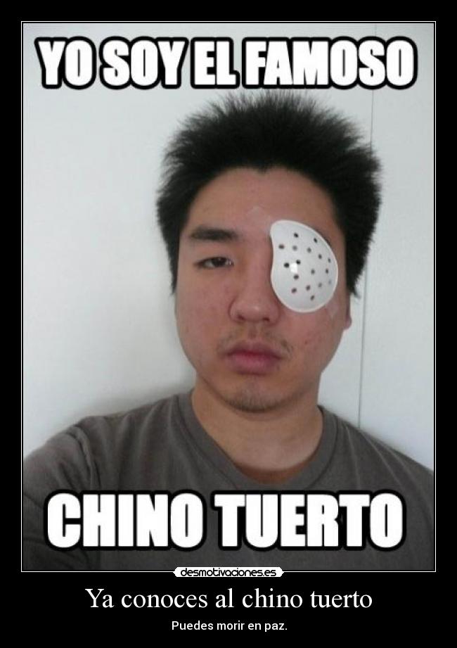 chino_tuerto.jpg