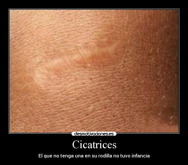 Cicatrices -