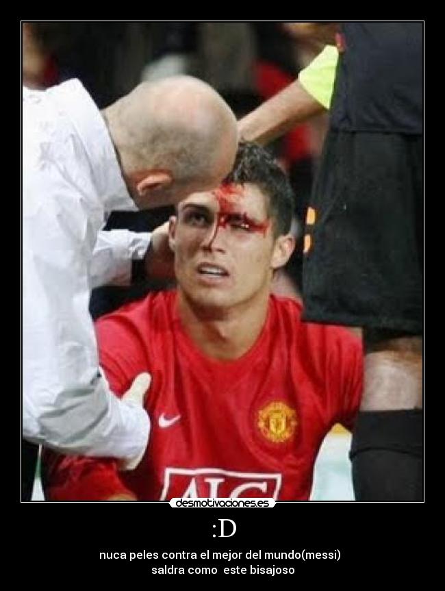 :D - nuca peles contra el mejor del mundo(messi)  
saldra como  este bisajoso