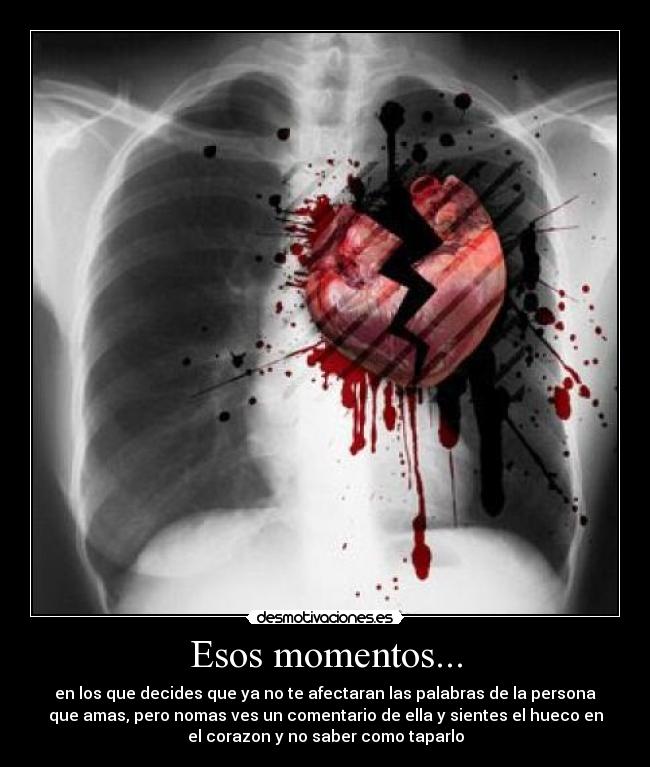 Esos momentos... -