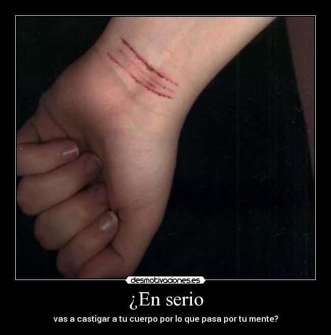 ¿En serio - 