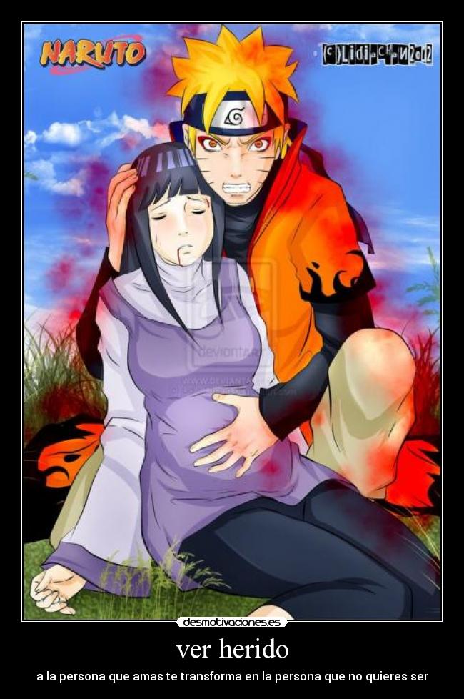 ver herido - a la persona que amas te transforma en la persona que no quieres ser