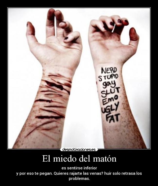 El miedo del matón - es sentirse inferior
y por eso te pegan. Quieres rajarte las venas? huir solo retrasa los problemas.