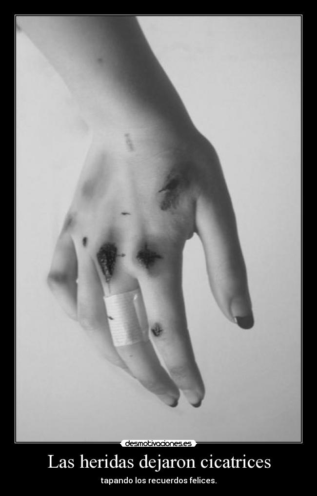 Las heridas dejaron cicatrices - 
