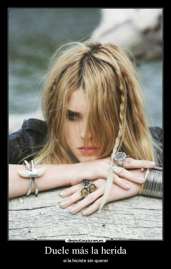Duele más la herida -