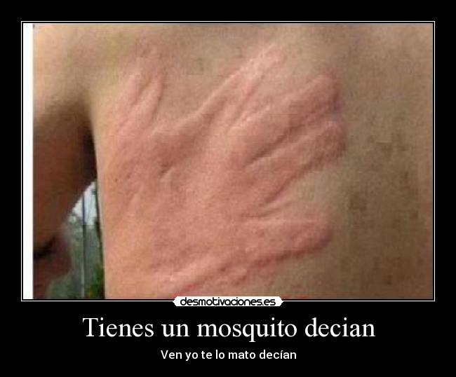 Tienes un mosquito decian -