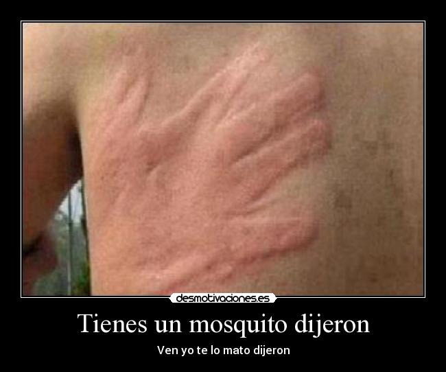 Tienes un mosquito dijeron - 