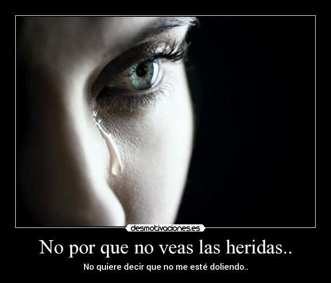 No por que no veas las heridas.. - 