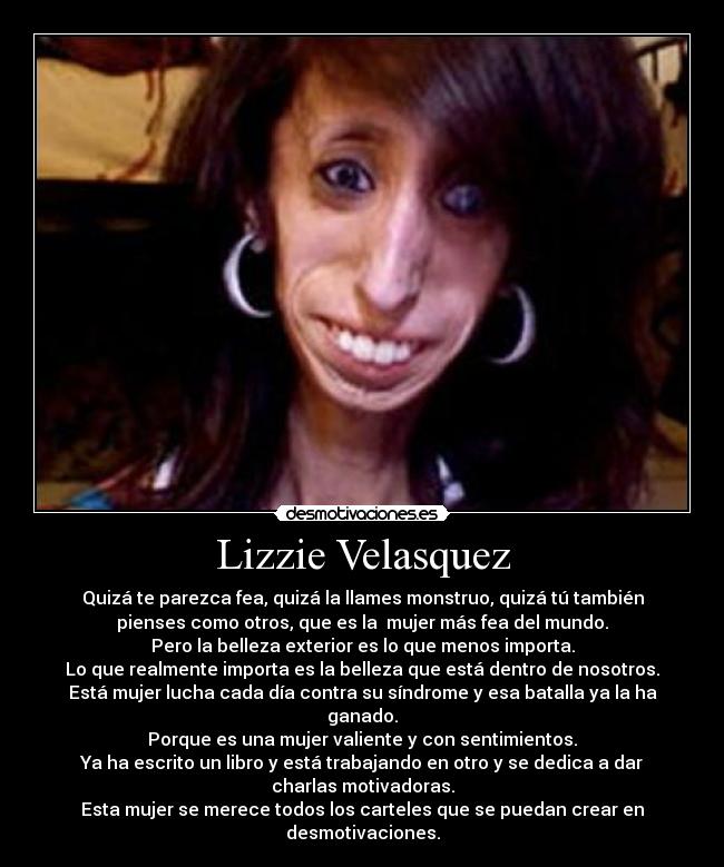 Lizzie Velasquez - Quizá te parezca fea, quizá la llames monstruo, quizá tú también
pienses como otros, que es la  mujer más fea del mundo.
Pero la belleza exterior es lo que menos importa.
Lo que realmente importa es la belleza que está dentro de nosotros.
Está mujer lucha cada día contra su síndrome y esa batalla ya la ha
ganado.
Porque es una mujer valiente y con sentimientos.
Ya ha escrito un libro y está trabajando en otro y se dedica a dar
charlas motivadoras.
Esta mujer se merece todos los carteles que se puedan crear en
desmotivaciones.