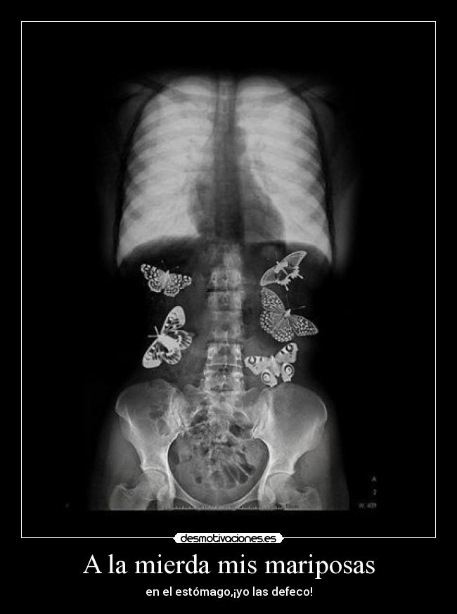 A la mierda mis mariposas - en el estómago,¡yo las defeco!