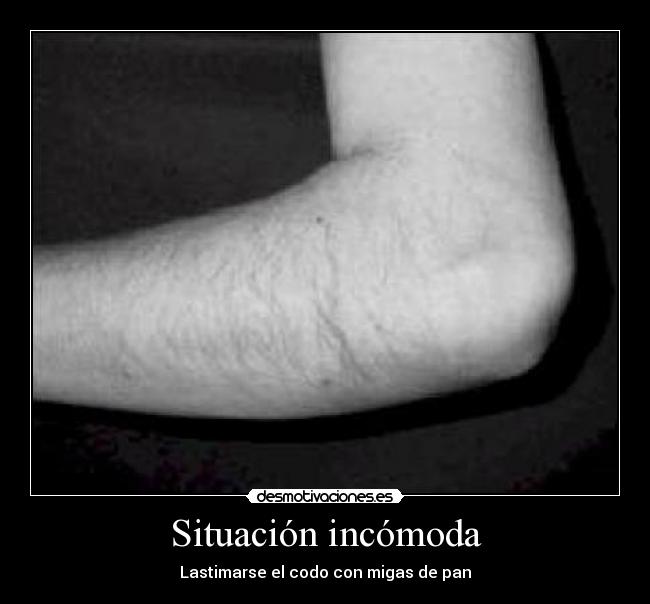 Situación incómoda - Lastimarse el codo con migas de pan