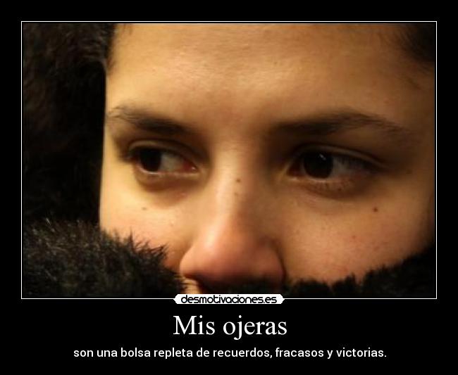 Mis ojeras - 