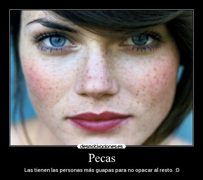 Pecas - Las tienen las personas más guapas para no opacar al resto. :D