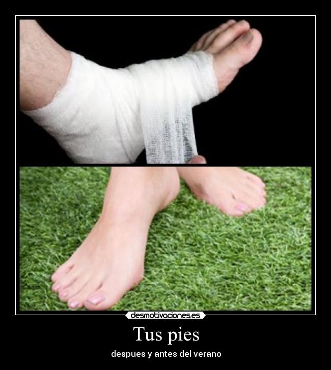 Tus pies - despues y antes del verano
