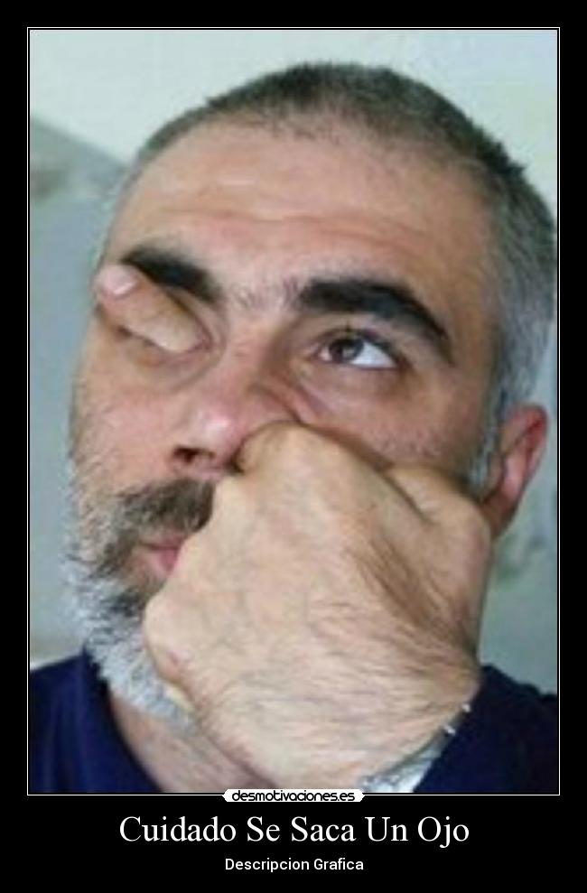 Cuidado Se Saca Un Ojo - Descripcion Grafica