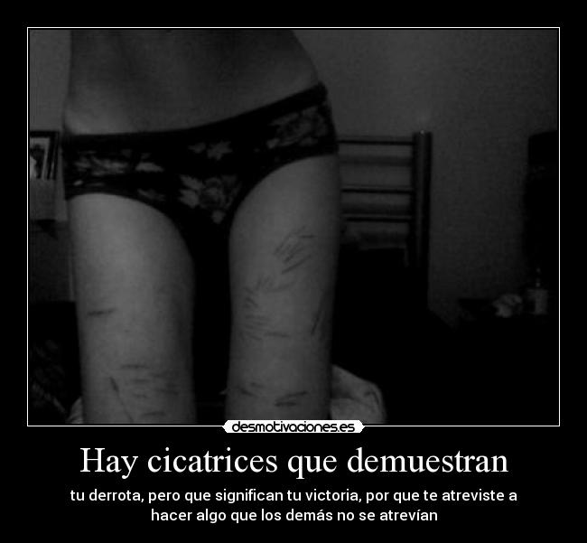 Hay cicatrices que demuestran -