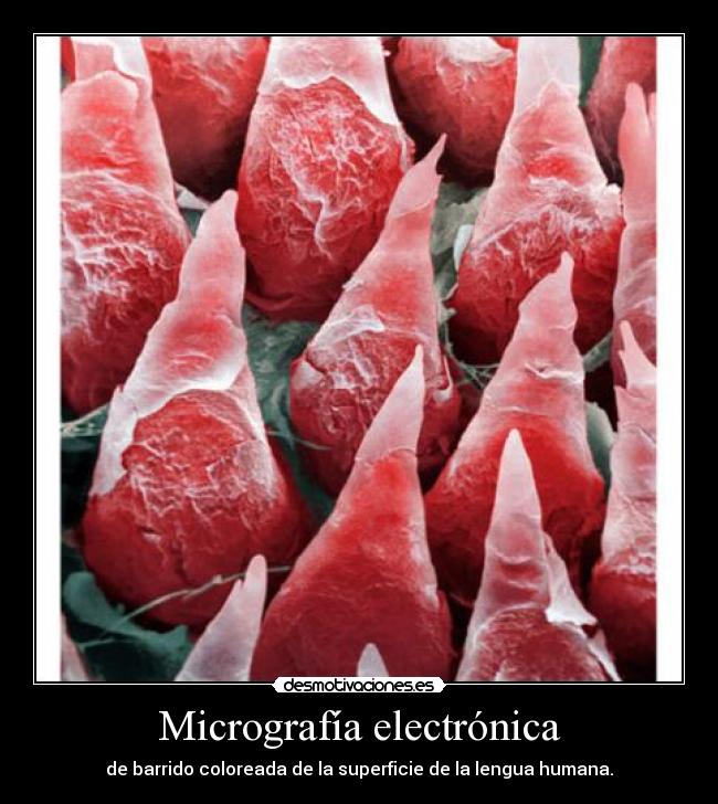 Micrografía electrónica - de barrido coloreada de la superficie de la lengua humana.