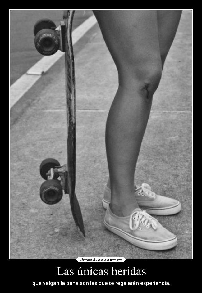 Las únicas heridas -