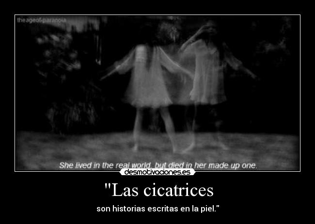 Las cicatrices - son historias escritas en la piel.