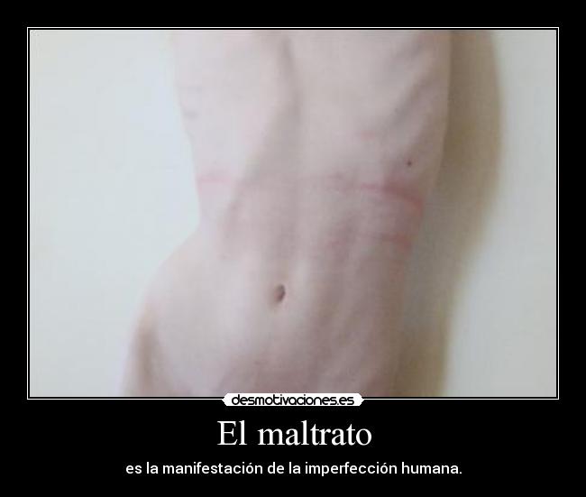 El maltrato - es la manifestación de la imperfección humana.