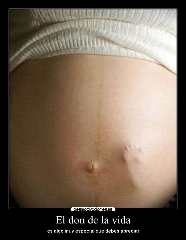 carteles vida don vida especial bebe mama embarazo desmotivaciones