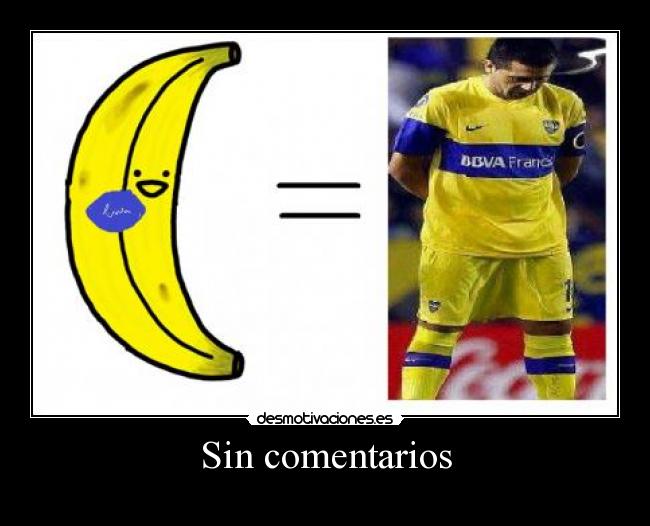 Sin comentarios -