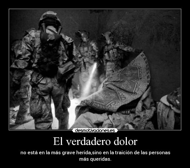 El verdadero dolor -