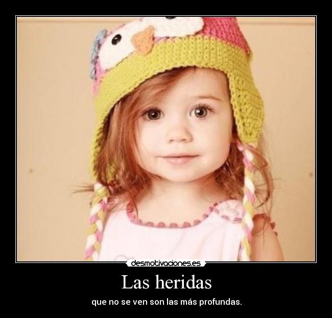 Las heridas - que no se ven son las más profundas.