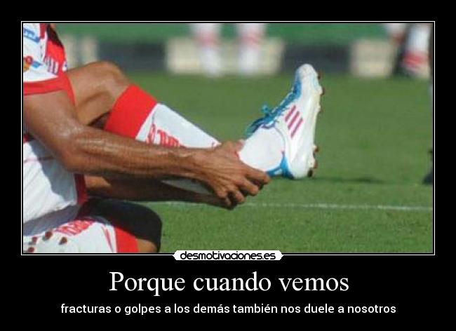 Porque cuando vemos - 