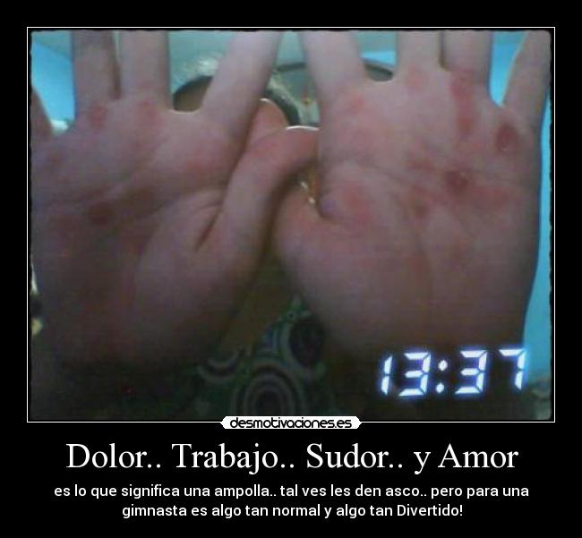 Dolor.. Trabajo.. Sudor.. y Amor - es lo que significa una ampolla.. tal ves les den asco.. pero para una
gimnasta es algo tan normal y algo tan Divertido!