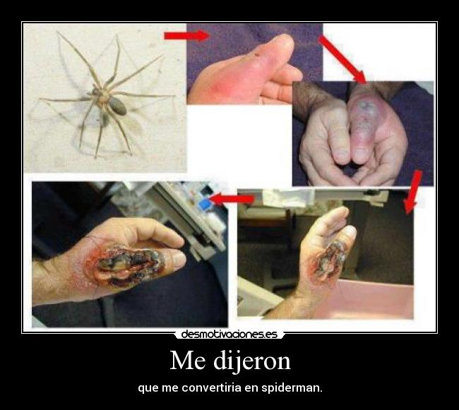 Me dijeron - que me convertiria en spiderman.