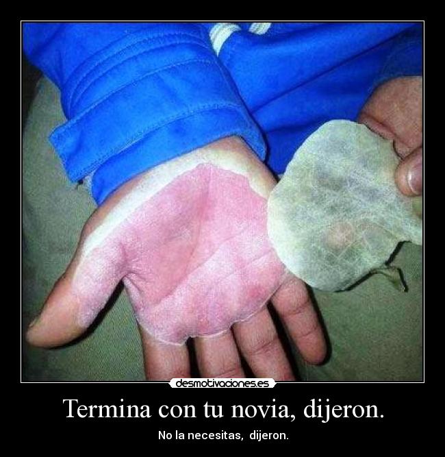 Termina con tu novia, dijeron. - 