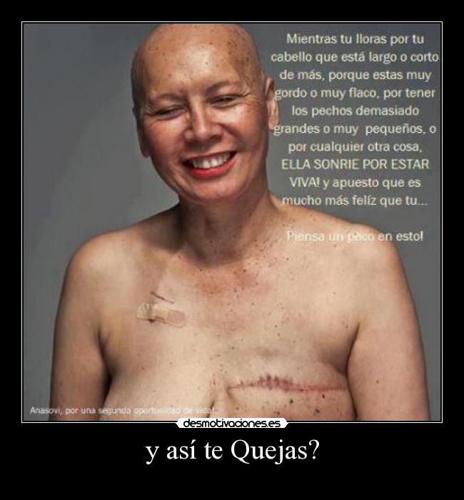 y así te Quejas? -