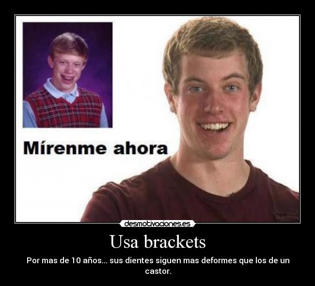 Usa brackets - Por mas de 10 años... sus dientes siguen mas deformes que los de un castor.