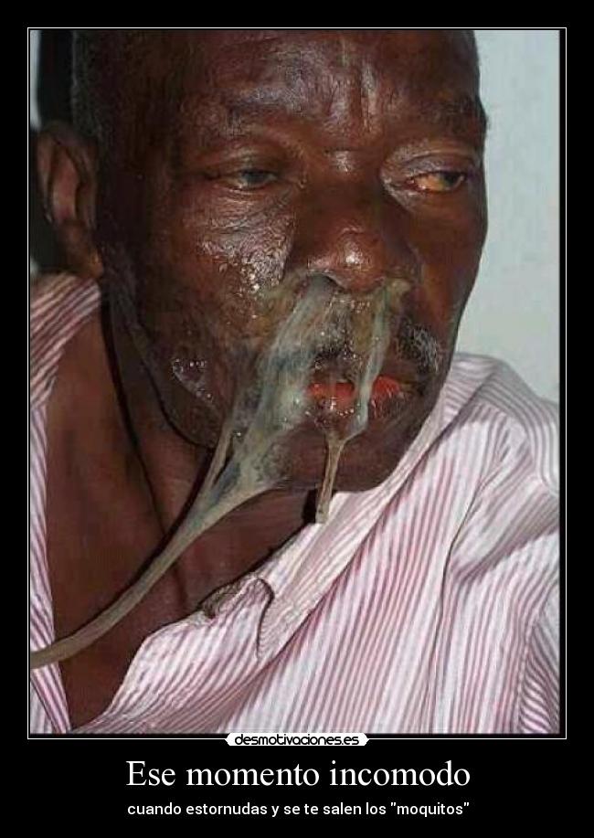 Ese momento incomodo - cuando estornudas y se te salen los moquitos