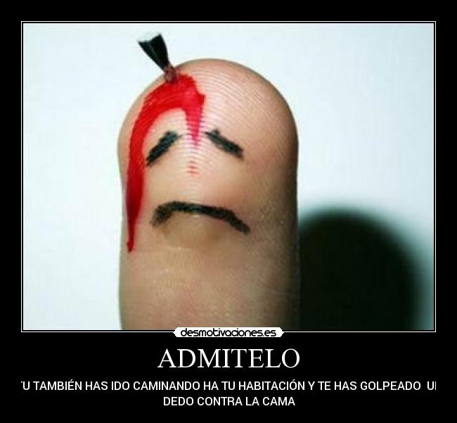 carteles dedo lastimado desmotivaciones