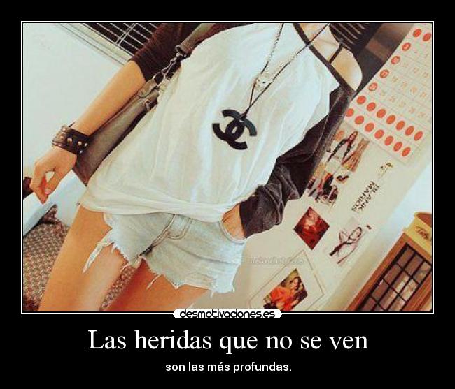 Las heridas que no se ven - son las más profundas.