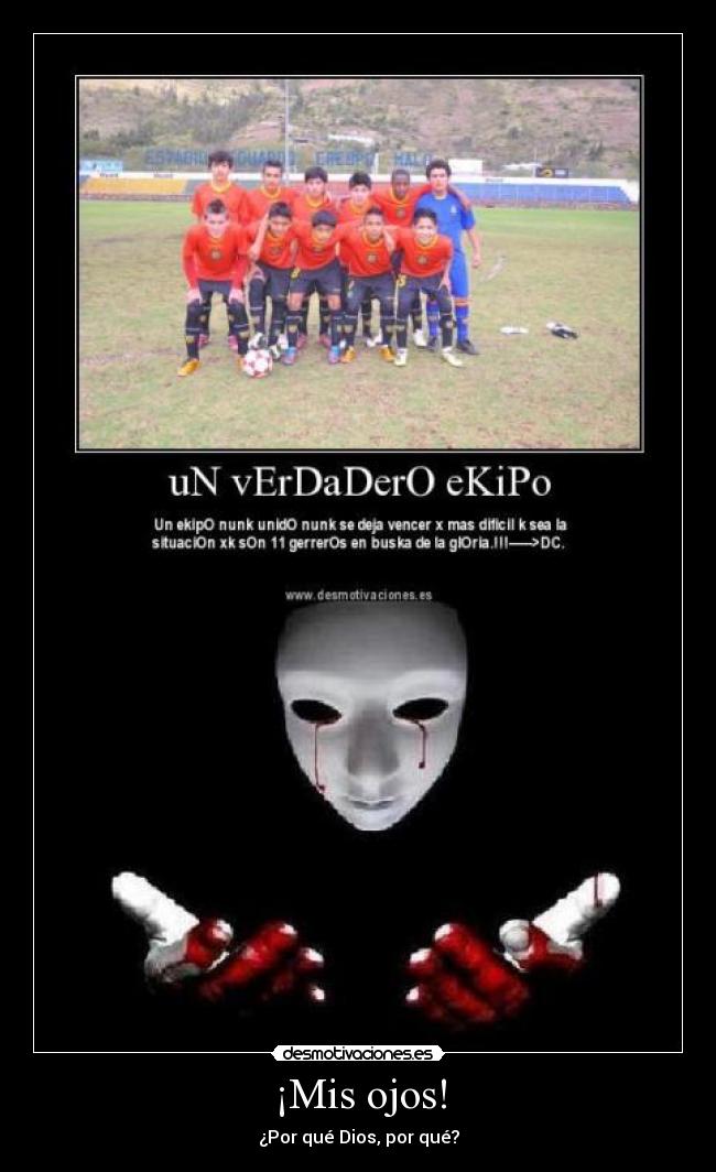 ¡Mis ojos! - ¿Por qué Dios, por qué?