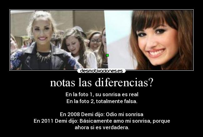 notas las diferencias? - En la foto 1, su sonrisa es real
En la foto 2, totalmente falsa.
En 2008 Demi dijo: Odio mi sonrisa
En 2011 Demi dijo: Básicamente amo mi sonrisa, porque
ahora si es verdadera.