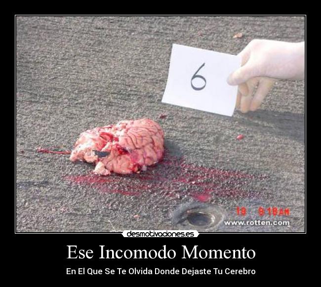 Ese Incomodo Momento - En El Que Se Te Olvida Donde Dejaste Tu Cerebro