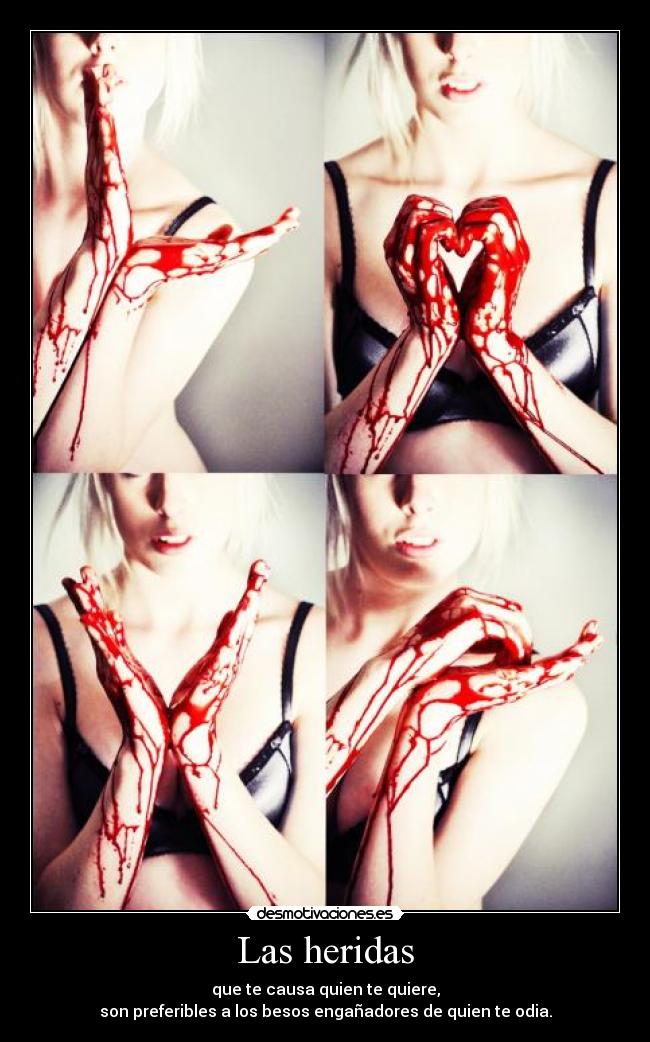 Las heridas - que te causa quien te quiere,
son preferibles a los besos engañadores de quien te odia.