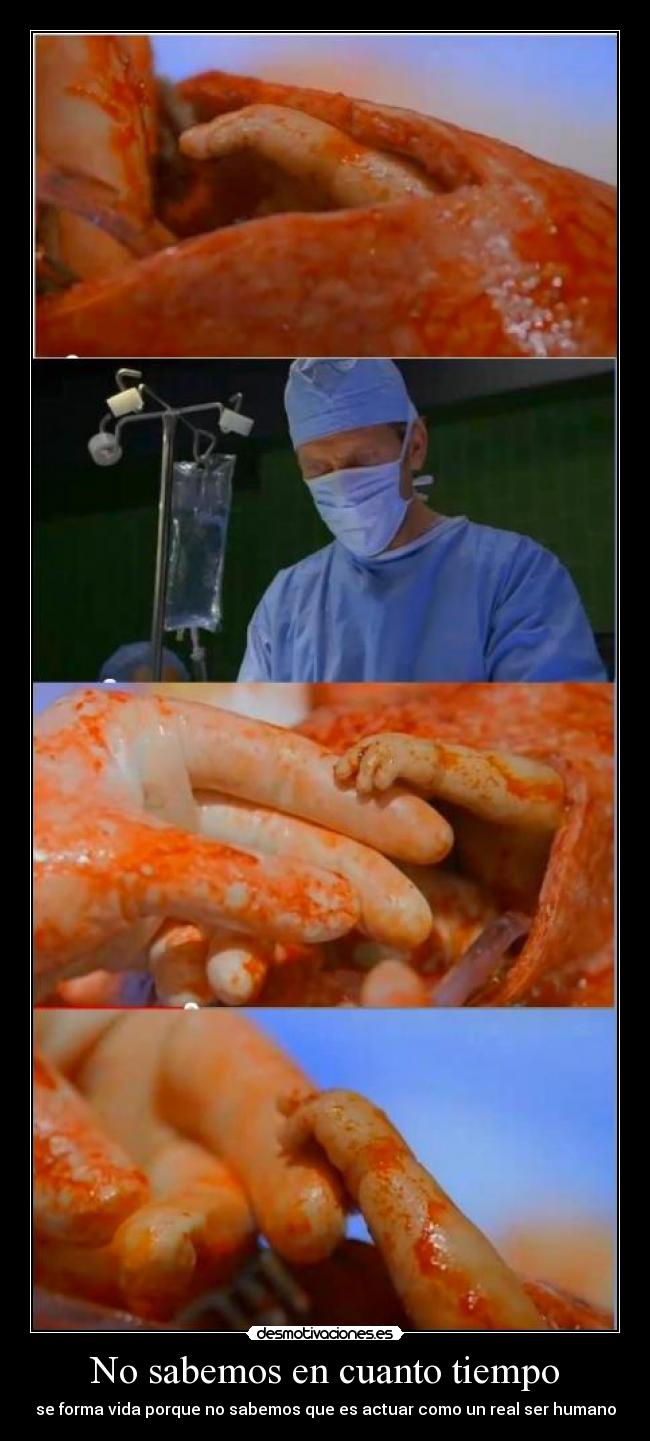 No sabemos en cuanto tiempo -