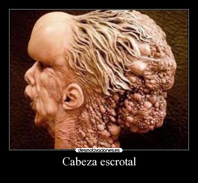 Cabeza escrotal -