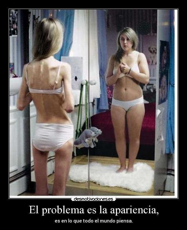 carteles apariencia anorexia desordenes alimenticios desmotivaciones